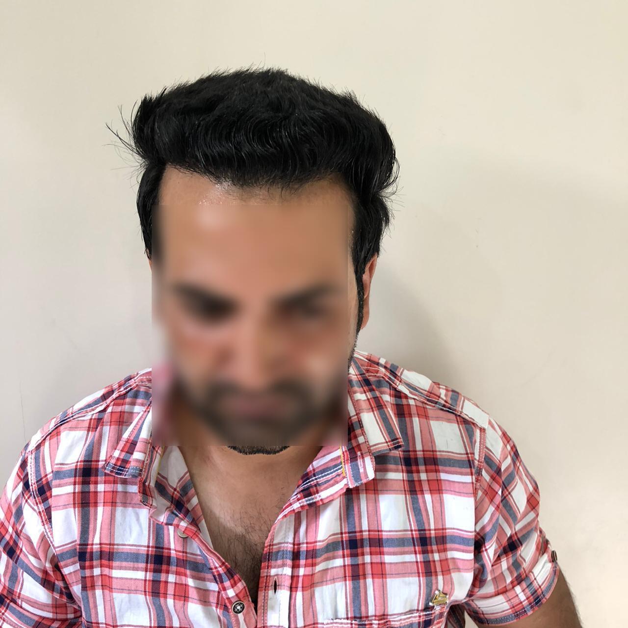 Home - Dr Ummer Yaseen's Skin, Laser And Hair Transplant Center